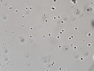 シュウ酸カルシウム結晶の写真